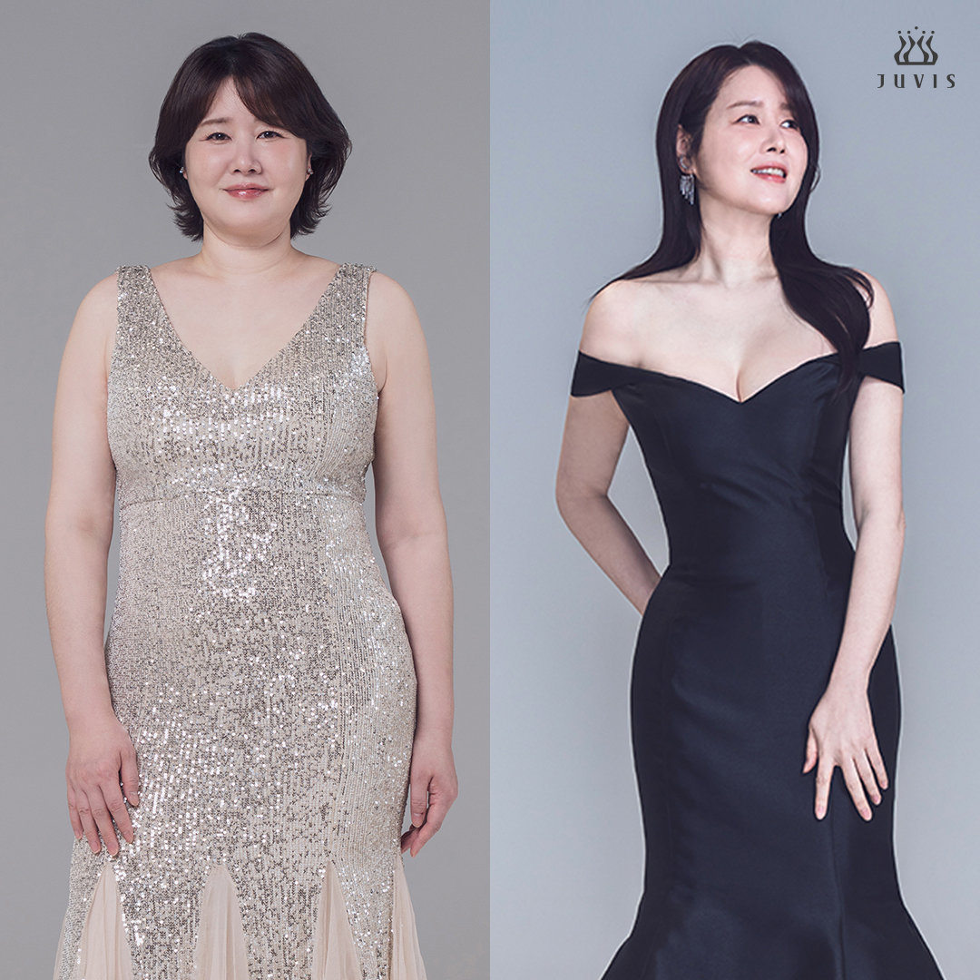 75kg→59kg…김지연, 다이어트 성공 “인생 뒤집혔다”
