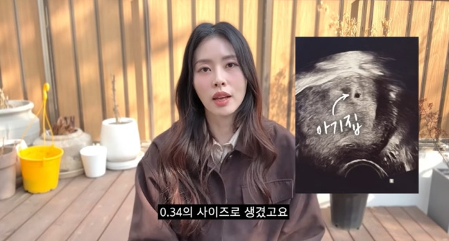 서동주 “임신 맞지만 불안”…아기집 0.67cm, 결과 대기