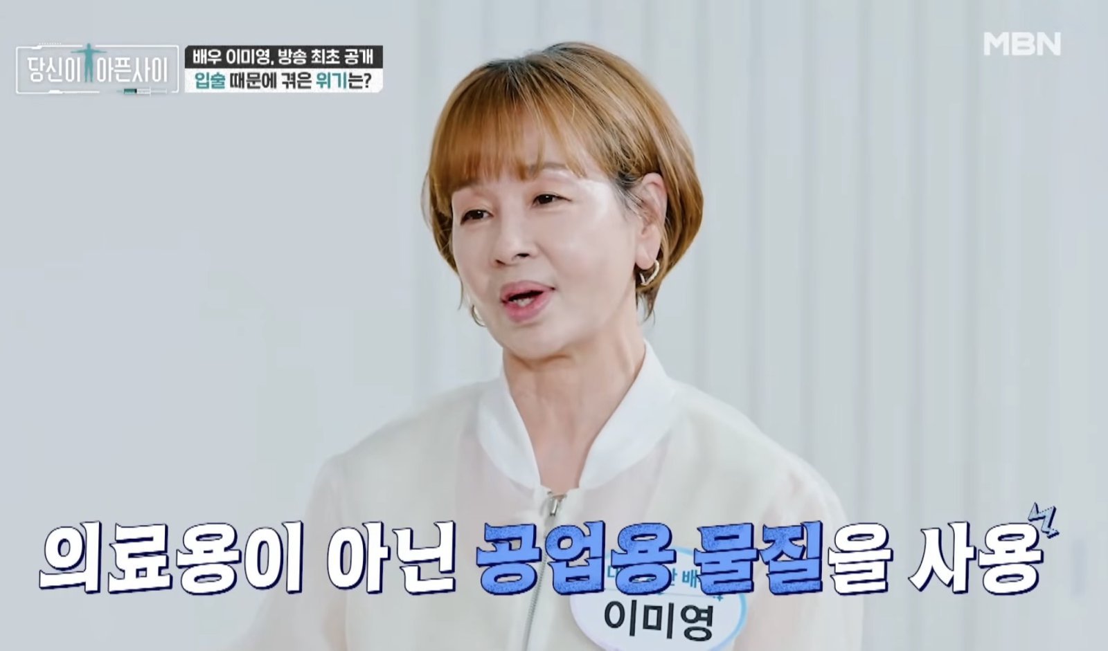 이미영 “입술 때문에 출연 끊겨”…공업용 시술 부작용 고백