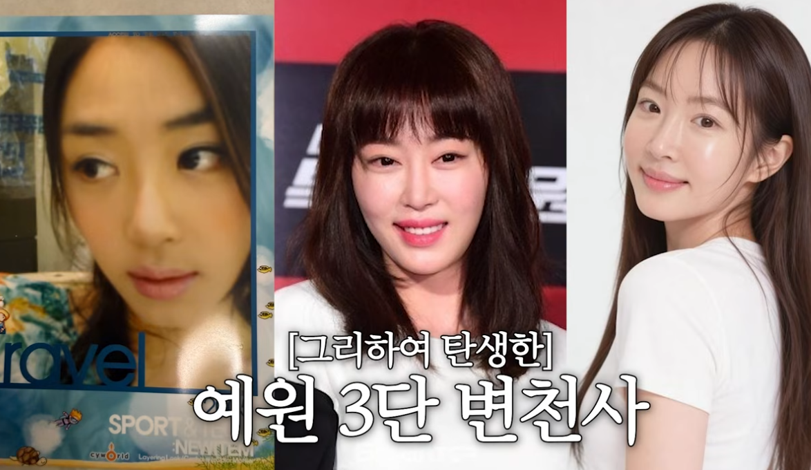 “성형 이야기 이제 그만”…강예원, 코 성형까지 밝혔다