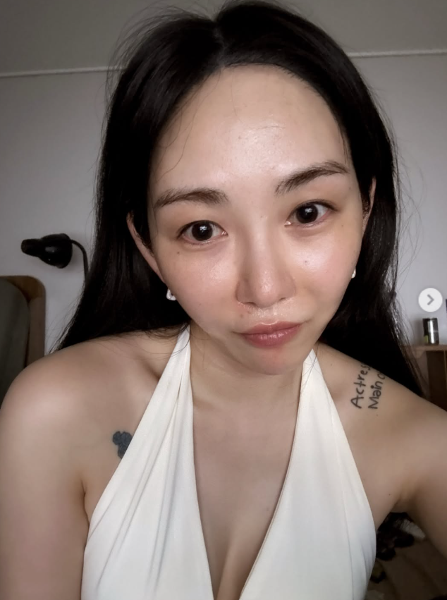 ‘AOA 출신’ 권민아, 의료사고 후 달라진 얼굴…화상 흉터에 응원 쏟아져 [SD셀픽]