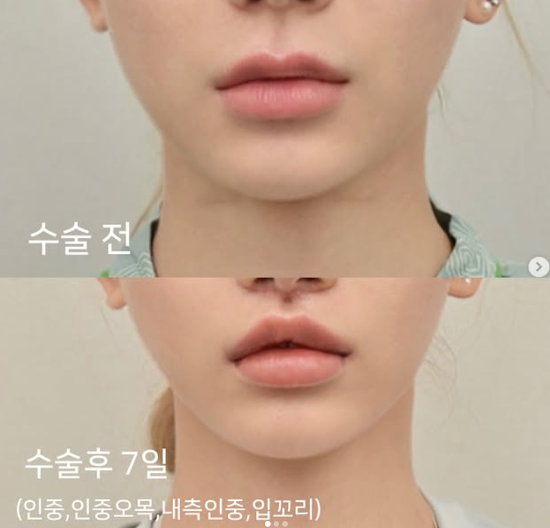 맹승지 SNS 캡처