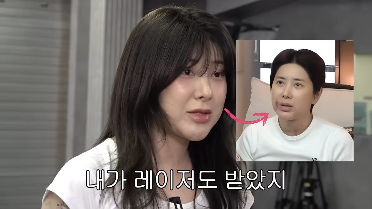 서인영, 지방흡입·레이저 받더니…“강유미·고윤정 그 사이”