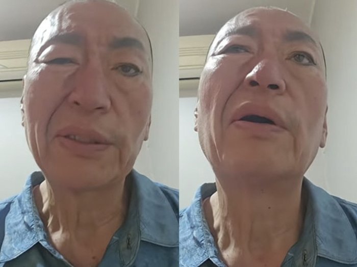 ‘결혼 8번’ 유퉁, 안면마비 증상 심각→활동 중단