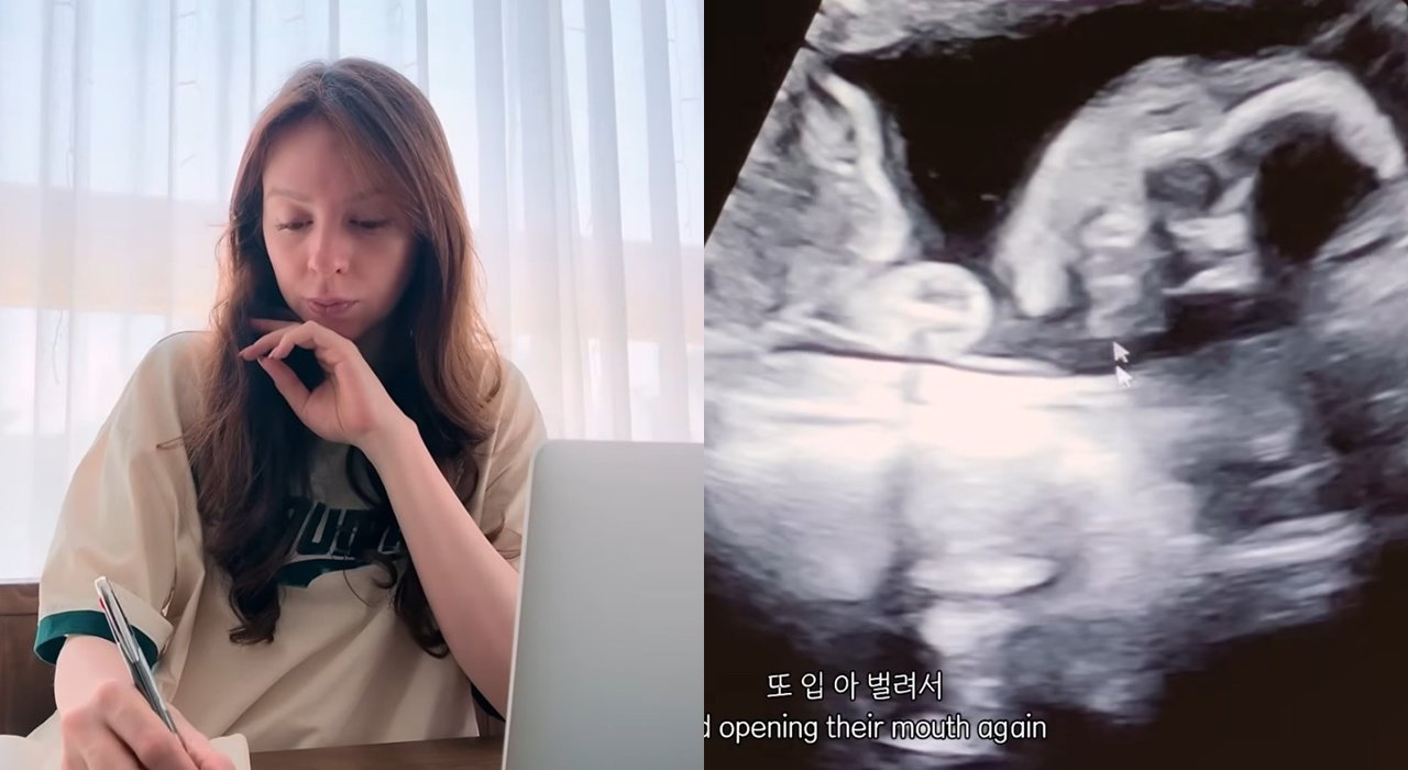 박주호♥안나, 넷째 임신…초음파 공개 “소중한 아기” [DA클립]