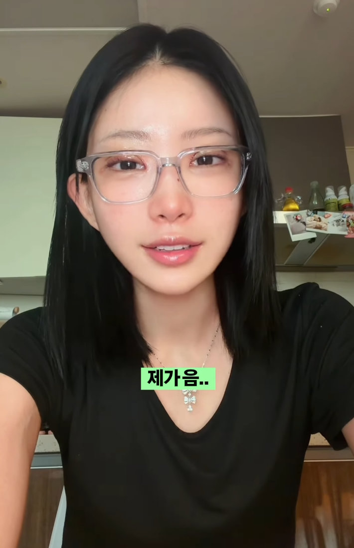 ‘故 최진실 딸’ 최준희, 세번째 ‘쌍수’ 성공적…‘외모 정병’ 솔직 고백