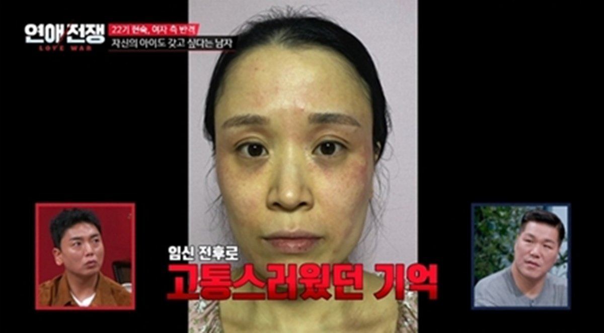 현숙