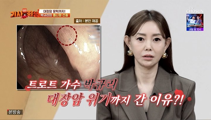 트로트 가수 박규리, 대장암 직전까지 갔다 “매년 용종 3~4개 제거”