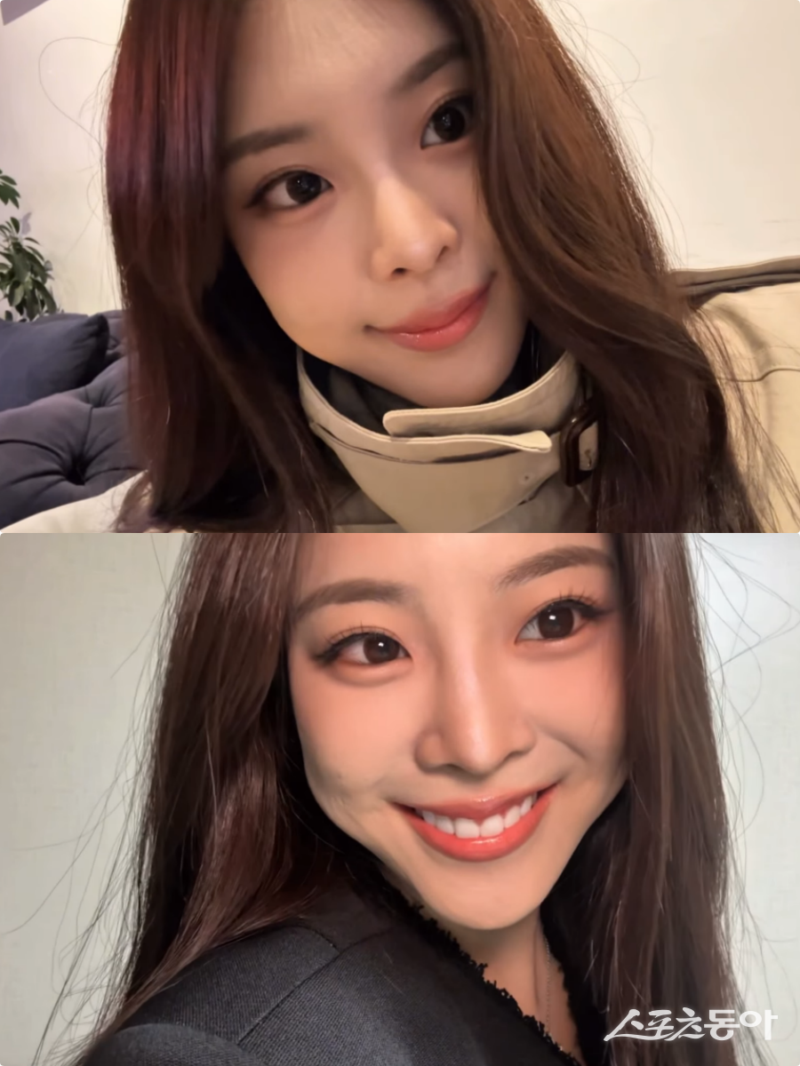 ‘우지원 딸’ 우서윤, 성형 의혹엔 침묵했지만…“웃을 때 신경 쓰여” 치아 시술 공개